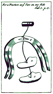 Single Side Jaw Luxation Dressings